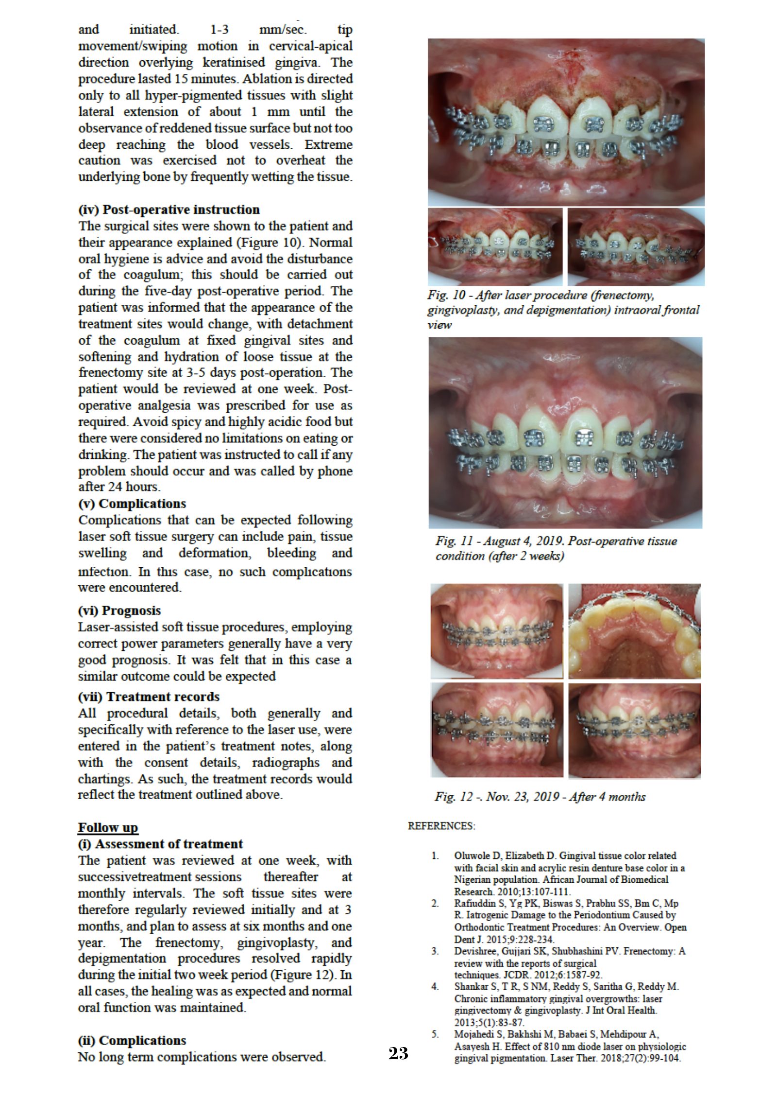 Page 23