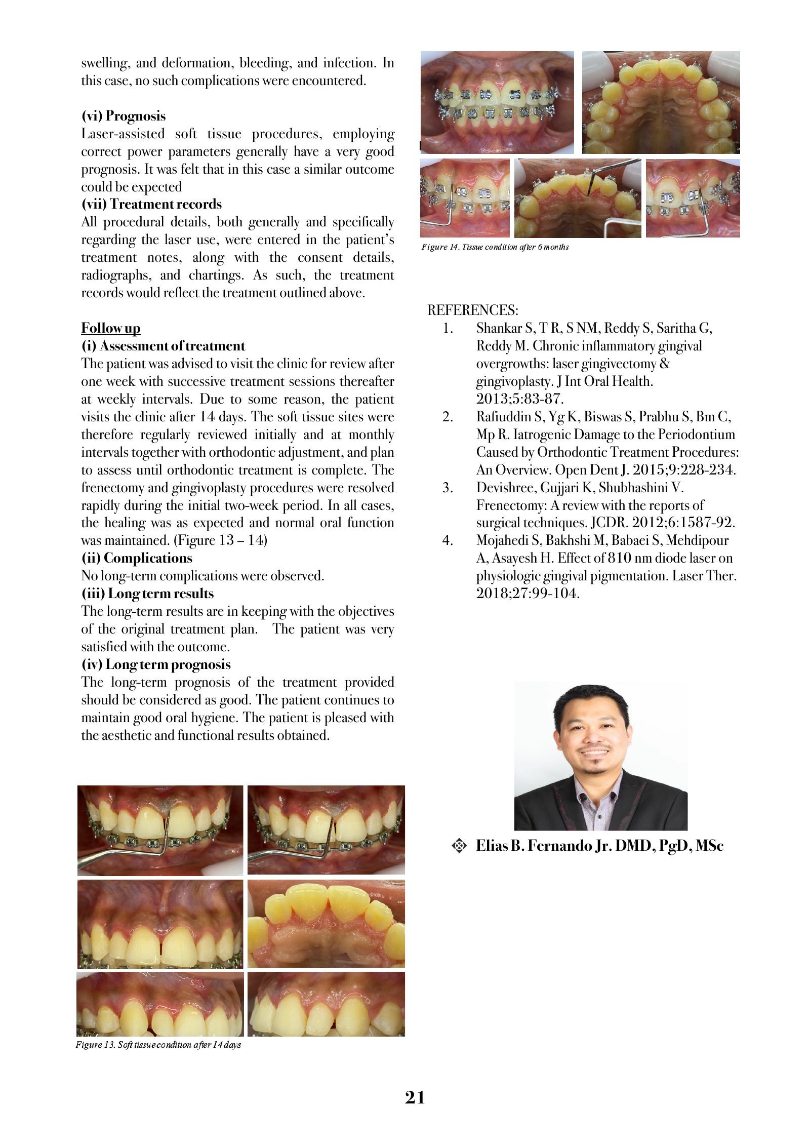 Page 21